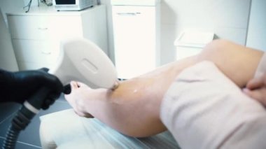 Yordam lazer epilasyon diode lazer üzerinde. Hisse senedi. Diode lazer kullanarak ayak üzerinde epilasyon. Epilasyon bacaklar cihazın üzerindeki