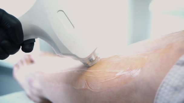 Procedure of laser hair removal on a diode laser. Stock. Hair removal on the legs using a diode laser. Hair removal on the legs device — Stock Video