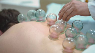 Vakum bankalar masaj. Spa salonda sırtında bankalar ile yatan adam Close-up. Tedavi ve kozmetik vakum bankalar