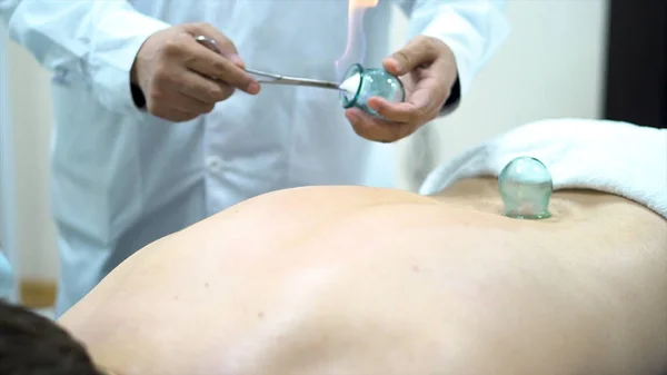 Akupunktur terapeut att placera en kopp på baksidan av en manlig patient, antika kinesiska alternativ medicin. Stäng för en läkare som ger koppning behandling på ung man tillbaka. — Stockfoto