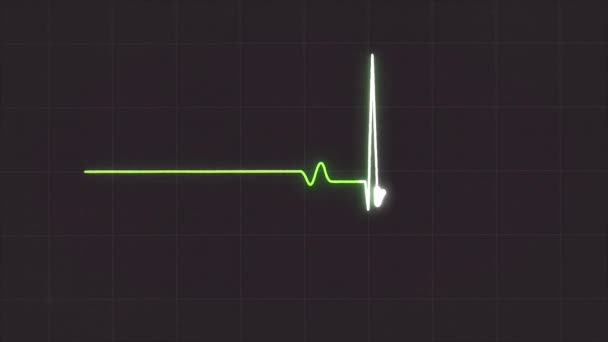 Анотація ЕКГ-монітор, що показує серцебиття на сірому фоні. Електрокардіограма зелених імпульсних хвиль в русі . — стокове відео