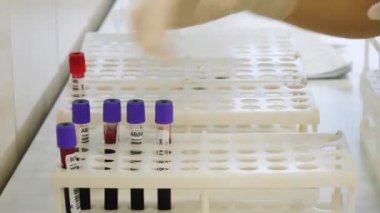 Bir doktorlar Close-Up kan test tüpleri ile laboratuarda çalışan giyen lastik eldiven eller. Çerçeve. Tıp ve sağlık.