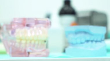 Bir diş hekimi ofisinde insan çene modelleri, diş bakımı ve protez konsepti için yakın. Medya. Diş ofisi masasında farklı diş alçı modelleri.