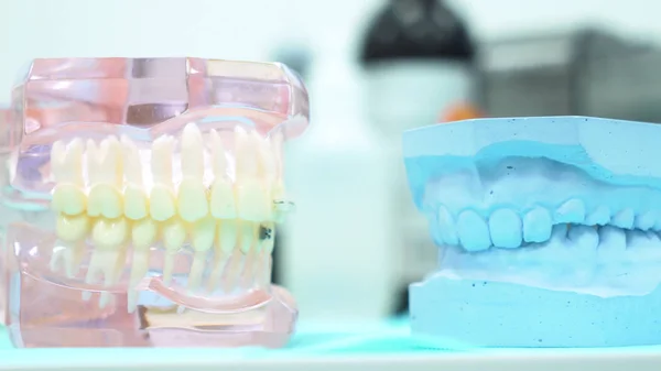 Zblízka na lidskou modelku u zubaře, na péči o zuby a v koncepci protetik. Media. Různé dentální sádrovské modely na stole zubní ordinace. — Stock fotografie