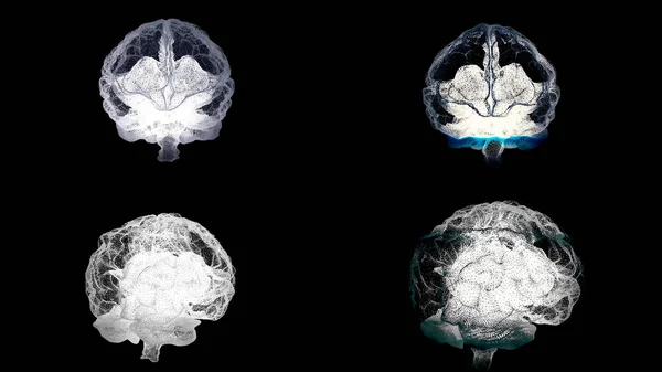 Четыре мозга вращаются с МРТ на черном фоне, концепция здоровья. Анимация. Мозг человека, правое и левое полушарие во время медицинской процедуры, бесшовный цикл . — стоковое фото