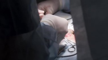 Steril bir odadaki ameliyat sürecinin detaylarını kapat. Başla. Güvenlik eldiveni takan doktorlar ameliyat aletleri ile ameliyat yapıyorlar ve bir hastanın hayatını kurtarıyorlar, tıp konsepti..