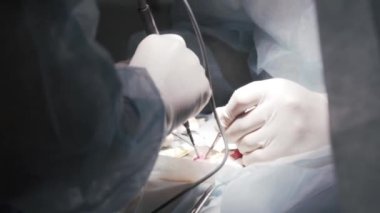 Prosedür, profesyonel ekipmanı olan bir hastaya uygulanır. Başla. Cerrahlar hastayı ameliyat odasına, sağlık ve tıp konseptine teslim ettiler.