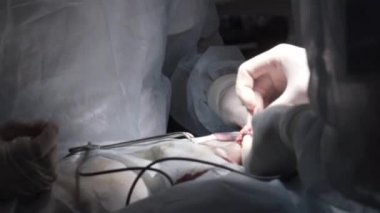 Profesyonel ekipmanlarla erkek üreme organlarının ameliyatının detaylarını kapat. Başla. Steril takım elbiseli cerrahlar tıbbi prosedür uyguluyor, prostatektomi yapılıyor..
