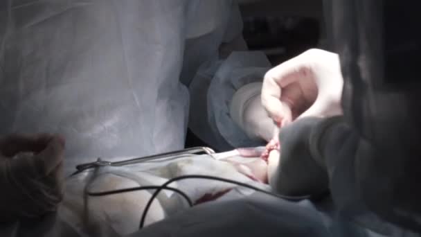 Close up detail of a surgery on male genitals with the professional equipment. Action. Surgeons in sterile suits performing medical procedure, process of prostatectomy. — Stock Video