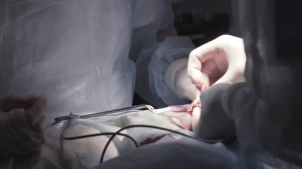 전문적 인 장비로 남자 성기에 대한 수술을 자세히 닫아. 행동. 무균 수술을 하는 외과의사, 전립선 절제술을 하는 모습. — 비디오