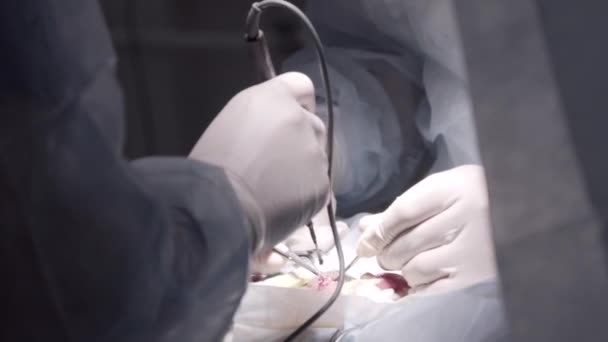 Închiderea procedurii se efectuează pe un pacient cu echipament profesional. Acţiune. Chirurgii mâini care operează pacientul în camera curată, conceptul de sănătate și medicină . — Videoclip de stoc