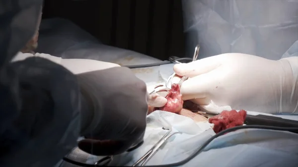Összevarrjuk a sebészeti sebet orvosi eszközökkel és macskabéllel. Felvétel. Közelkép a sebész kezét öltések egy sebet a műtét után a férfi nemi szervek. — Stock Fotó