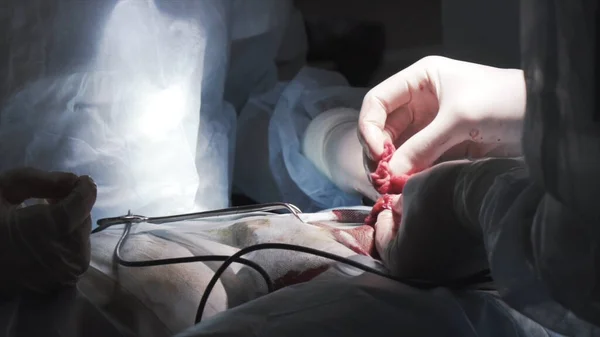 Close up detail of a surgery on male urogenital system. Action. Surgeons hands cutting out testicle malignant tumor with professional tools, concept of cancer disease and medicine. — стоковое фото