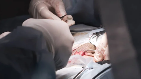 Szakmai sebészek közelsége, akik nyílt sebet varrnak az orvosi beavatkozás alatt. Felvétel. Orvosok tiszta egyenruhában, macskabéllel a műtét befejezéséhez. — Stock Fotó