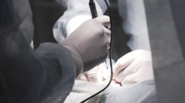 Healthcare workers doing male enhancement surgery. Action. Close up of penis enlargement surgery in operating theater, concept of sex health medicine.