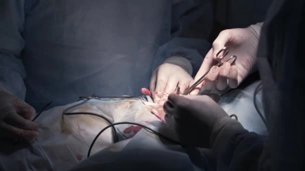 外科医はステッチを適用する。行動だ。麻酔下で複雑な手術を完了プロの外科医のクローズアップ.手術室での縫合糸 — ストック動画