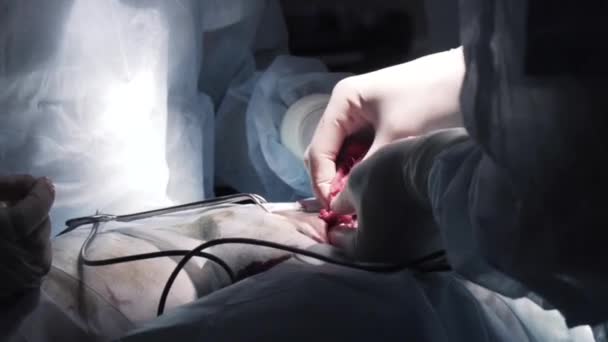 Close up detail of a surgery on male urogenital system. Action. Surgeons hands cutting out testicle malignant tumor with professional tools, concept of cancer disease and medicine. — Vídeo de stock