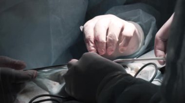 Dikiş atan cerrahlar. Başla. Karmaşık ameliyatları dikiş atarak tamamlayan iki cerrah. Cerrahlar anestezi altında ameliyatlarını başarıyla tamamladılar ve dikiş atıyorlar.
