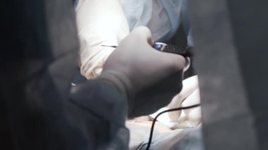 Team surgeon at work in operating room. Action. Close up of penis enlargement surgery to increase the size of a man penis, concept of male enhancement.