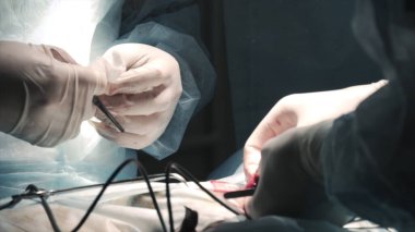 Cerrahlar anestezi altında ameliyat yapıyorlar. Başla. Yakın plan cerrahlar insan tümörünü anestezi altında açarlar. Yaraların düzeltilmesi ve hastalıkların ortadan kaldırılması ile cerrahi tedavi