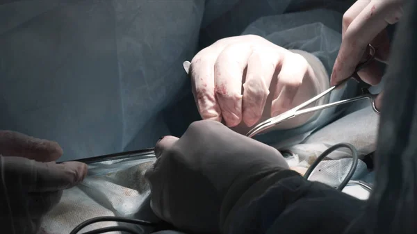 Cirujanos realizando operación bajo anestesia. Acción. Cirujanos de cerca abren tumor humano bajo anestesia. Tratamiento quirúrgico con corrección de lesiones y eliminación de enfermedades — Foto de Stock