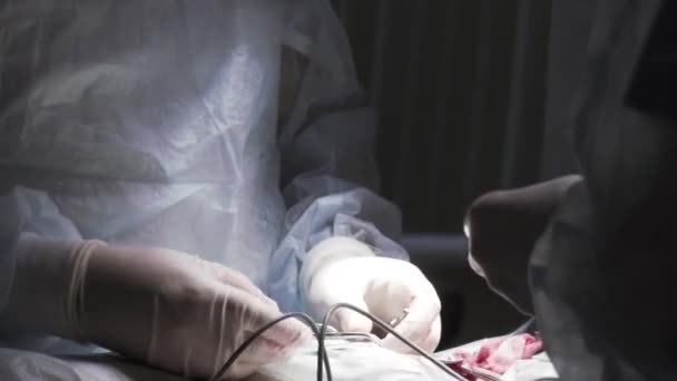 Lékařské zázemí s detaily operace. Akce. Procedurální chirurgická operace prováděná skupinou profesionálních chirurgů v čisté místnosti se speciálním vybavením. — Stock video