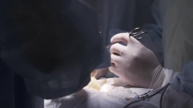 Close up of circumcision surgery on male penis. Action. Doctors are going to circumcise the foreskin of man genitals with medical equipment in operating room.