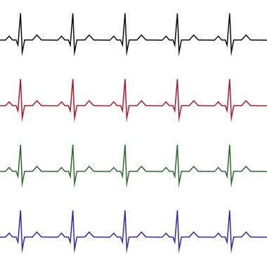 Kalp hızı grafik. Vektör çizim. (Elektrokardiyogram veya EKG)