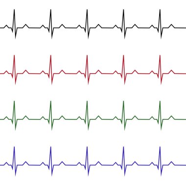 Kalp hızı grafik. Vektör çizim. (Elektrokardiyogram veya EKG)