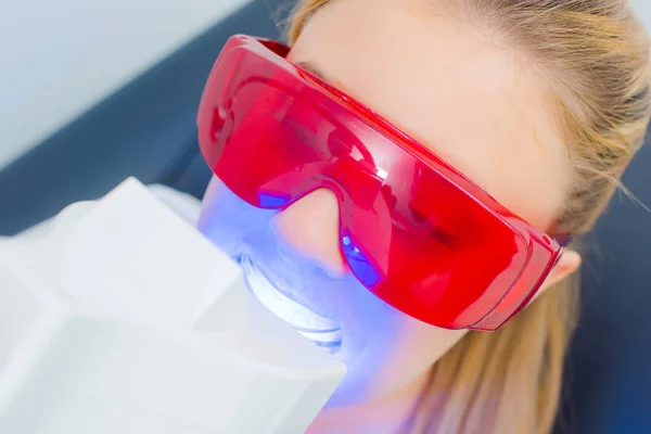 Denti laser appassimento e laser — Foto Stock