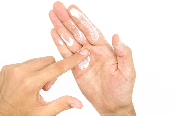 Mann Cremt Hände Mit Feuchtigkeitscreme Ein Trockene Haut — Stockfoto