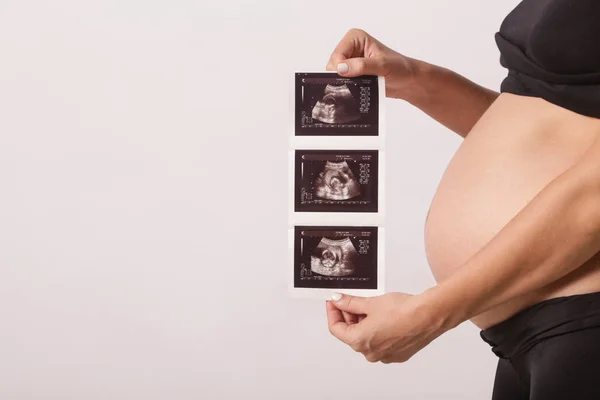 Schwangere Mit Ultraschalluntersuchung — Stockfoto