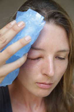 Eşek arısı sokmasından dolayı gözü şişmiş beyaz bir kadın. Eşek arısı ısırığına alerji reaksiyonu.