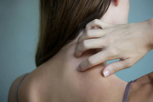 Vista Cerca Mujer Rascarse Cuello —  Fotos de Stock