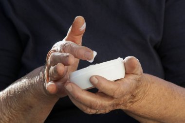 Kollarına nemlendirici losyon süren çok kuru ciltli yaşlı bir kadın.