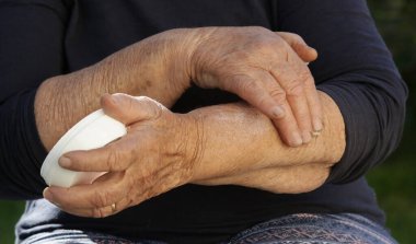 Kollarına nemlendirici losyon süren çok kuru ciltli yaşlı bir kadın.