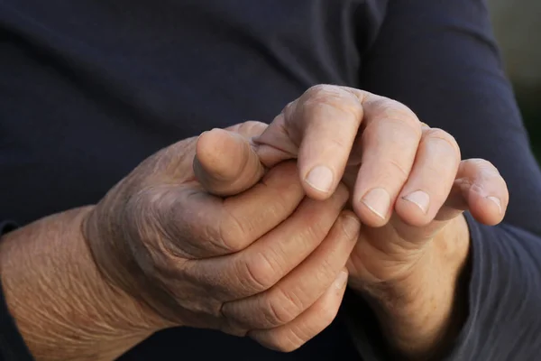 Mujer Anciana Que Sufre Dolor Manos Síntomas Artritis — Foto de Stock