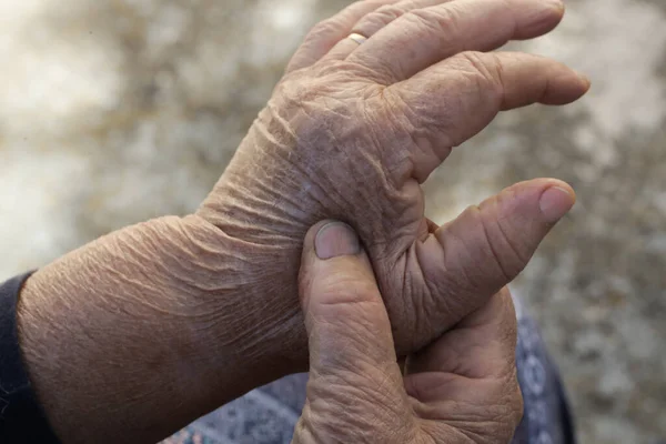 Femme Âgée Souffrant Douleurs Aux Mains Symptômes Arthritiques — Photo