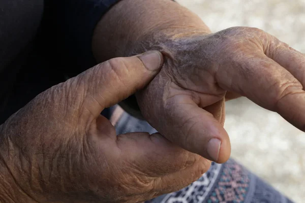 Femme Âgée Souffrant Douleurs Aux Mains Symptômes Arthritiques — Photo