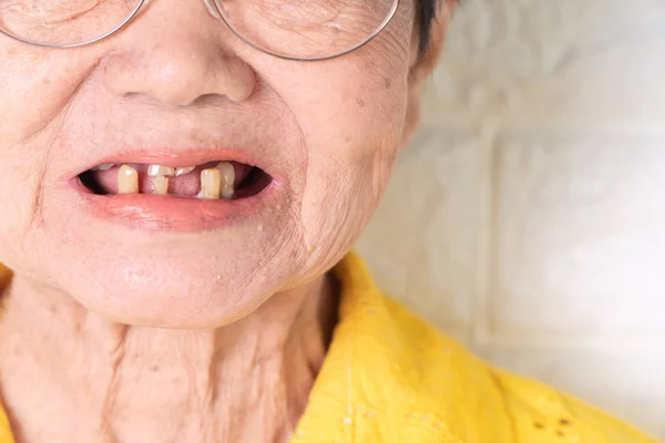 Asiática Anciana Mujer Más Años Edad Sonreír Con Unos Dientes — Foto de Stock