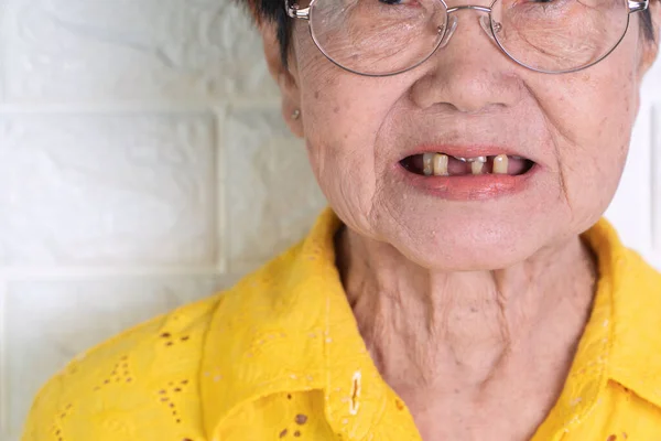 Asiática Anciana Mujer Más Años Edad Sonreír Con Unos Dientes — Foto de Stock