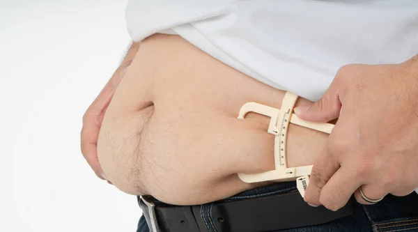 Close up of fat man hands measuring overweight belly by using body fat caliper