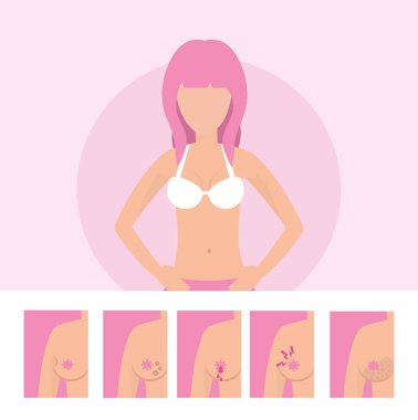 kadın meme kanseri hastalık vektör çizim ile hasta