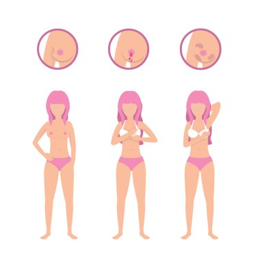 kadın meme kanseri survivor tedavi vektör çizim