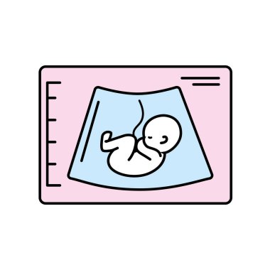 Ultrason bebek göbek kordonu vektör çizim ile