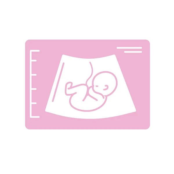 Ultrassom Silhueta Bebê Com Ilustração Vetor Cordão Umbilical — Vetor de Stock