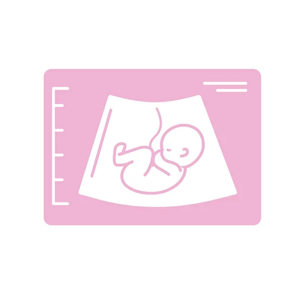 Silhouet Echografie Van Baby Met Navelstreng Vectorillustratie — Stockvector