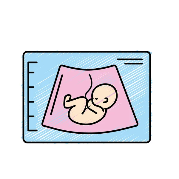 臍帯のベクトル図と赤ちゃんの超音波 — ストックベクタ