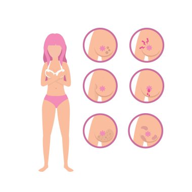 kadın meme kanseri tedavi umut tedavi vektör çizim