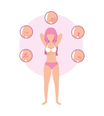 kadın meme kanseri tedavi tedavi vektör çizim